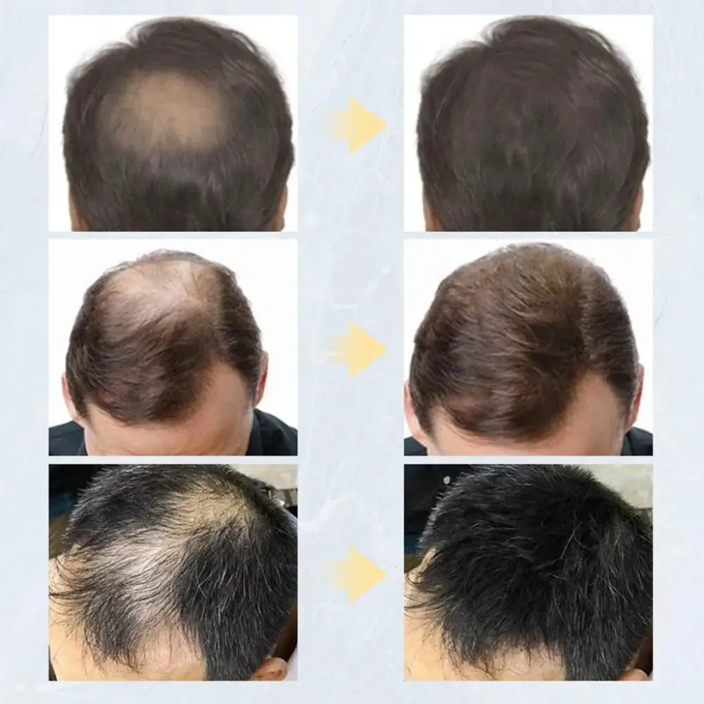 Спрей-апликатор за изграждане на влакна от косопад и средство за оптимизиране на линията на растеж на косата Средство за изграждане на влакна от загуба на коса е най-Добрият коректор от косопад . ' - ' . 5