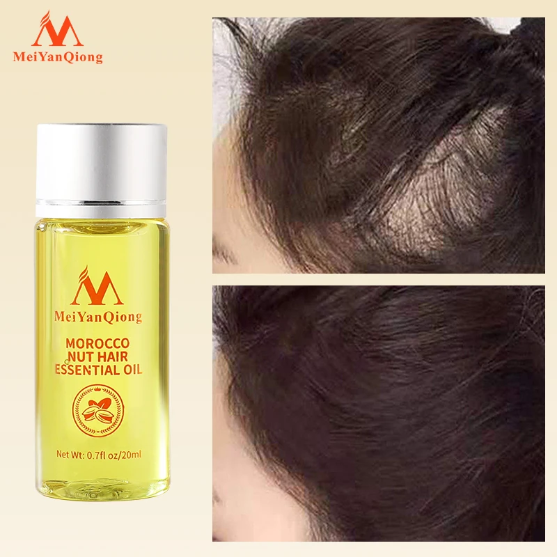 Етерично масло Арганы MeiYanQiong за растежа на косата, Предпазва от косопад и стимулира растежа на косата Изсветлява и изглажда затлъстяване контролира съдържанието на мазнини на косата . ' - ' . 1