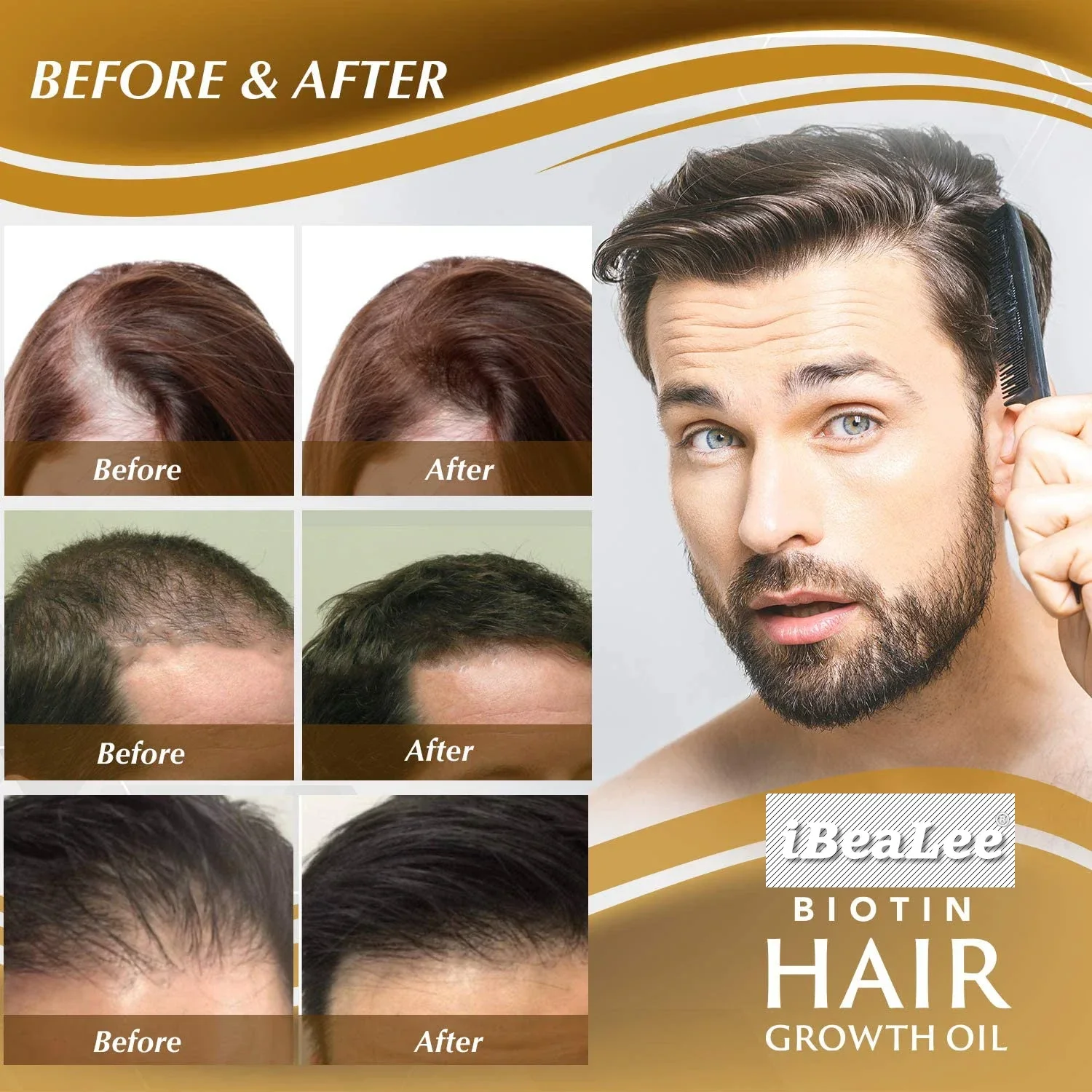 Средства за растежа на косата Биотиновый спрей срещу загуба на коса, грижа за кожата на главата, грижа за бърз растеж, етерични масла за мъже и жени, грижа за косата . ' - ' . 5