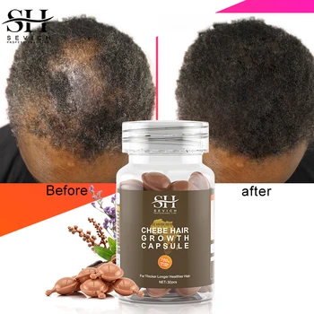 Горещи Продажба на Капсули масло за растежа на косата Chebe African Traction За Лечение на Алопеция Срещу Косопад Стягащ Спрей отърви се От Перуки