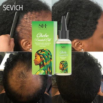 Африканско масло за бърз растеж на косата Chebe За жени, средство против косопад, Копър, за да се грижи за чуплива коса, Изкупителната от перуки